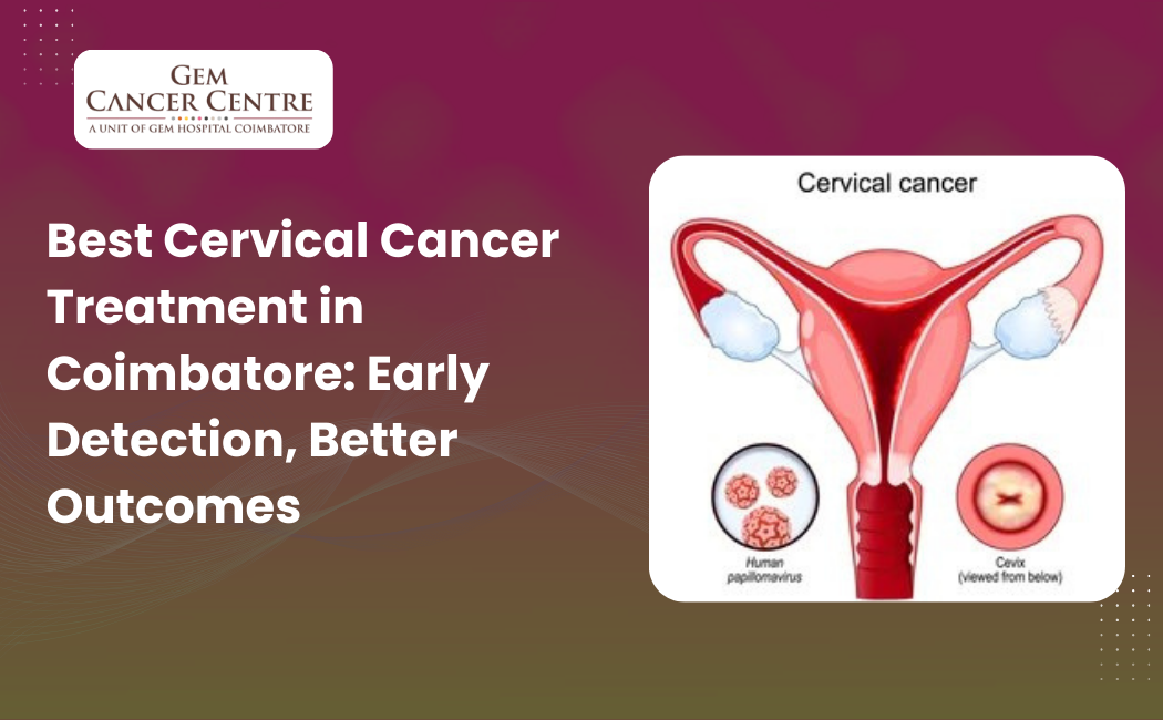 Best Cervical Cancer Treatment in Coimbatore: Early Detection, Better Outcomes